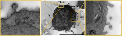 The multiple faces of extracellular vesicles released by microglia: Where are we 10 years after?